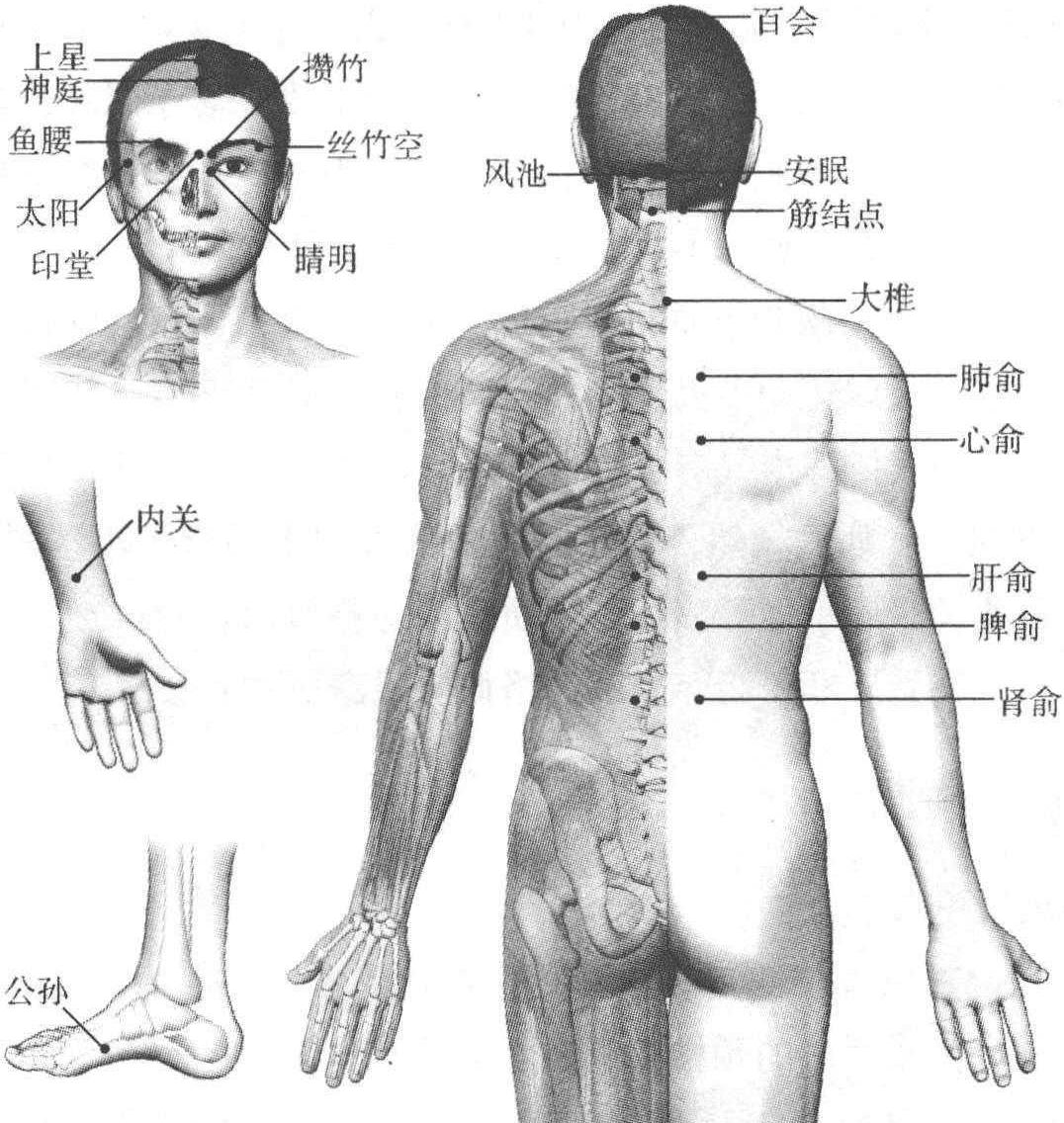 三、上瞼下垂